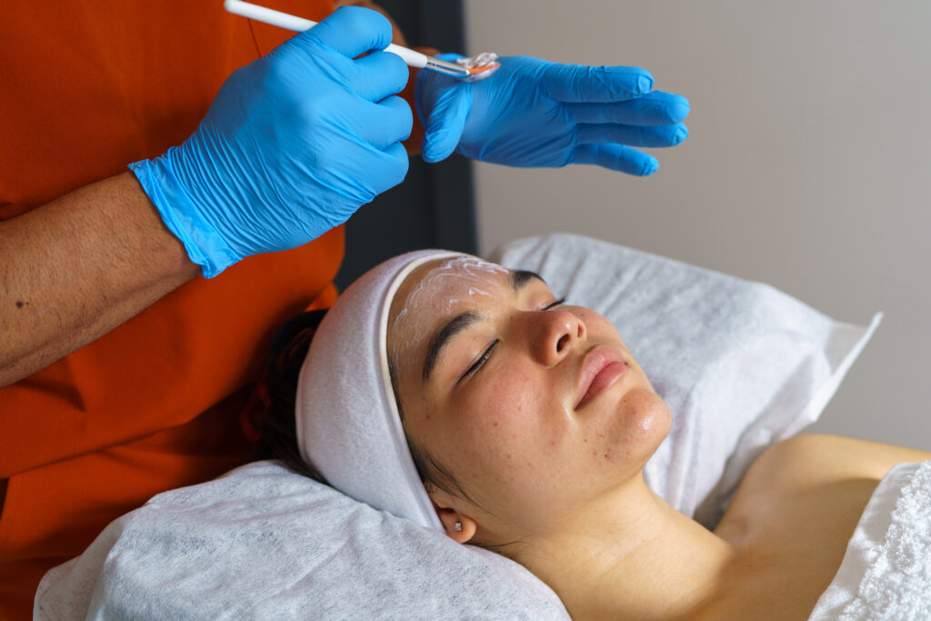 Woman undergoes a chemical peel to address skin imperfections. Woman undergoes a chemical peel to address skin imperfections.